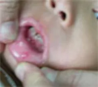 Nhiều quận, huyện chưa làm tốt công tác phòng chống dịch bệnh