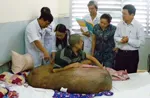 Dự kiến vào tháng 11 sẽ phẫu thuật cho bệnh nhân có khối u nặng trên 80kg