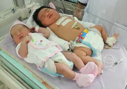 TPHCM: Bé sơ sinh nặng 6 kg  