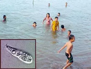 Người dân nên đề phòng nhiều bệnh nhiễm nguy hiểm hiện nay