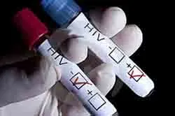 Năm 2013, mỗi ngày có trên 30 người nhiễm mới HIV