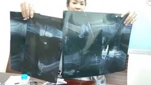 Trục lợi từ túi tiền bệnh nhân