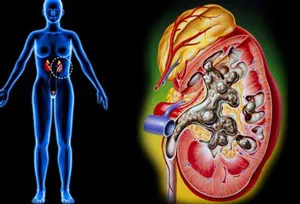 Trên 6% dân số bị bệnh thận mạn