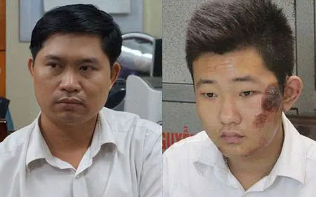 Vụ Cát Tường: Bị cáo Tường tiêm thuốc mê vượt 1,5 lần chuẩn quốc tế