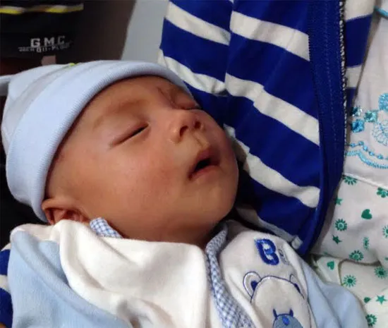 Em bé bị dao đâm xuyên sọ đã phục hồi hoàn toàn