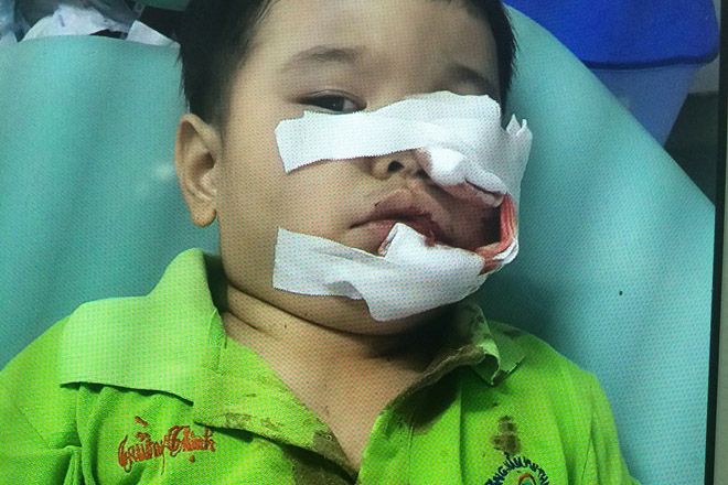 Nhà có trẻ nhỏ, người dân không nên nuôi chó