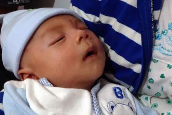 Em bé bị dao đâm xuyên sọ đang điều trị viêm màng não thể nặng