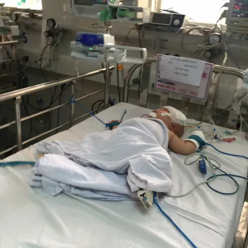 Em bé bị dao đâm xuyên sọ vẫn phải tiếp tục theo dõi
