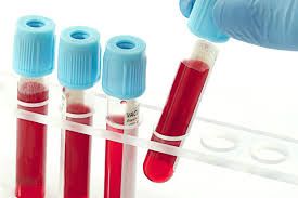 Viện Pasteur có thể xét nghiệm chẩn đoán bệnh nhân mắc virus Zika