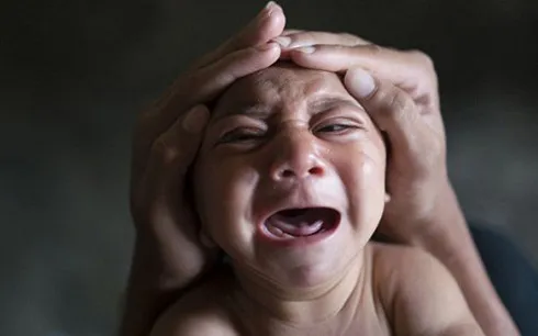 Dịch bệnh do virus Zika có thể đã lan đến nước Mỹ