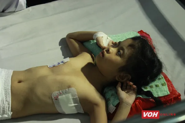 Trẻ bị lõm ngực cần được phẫu thuật độ tuổi từ 8 đến 12