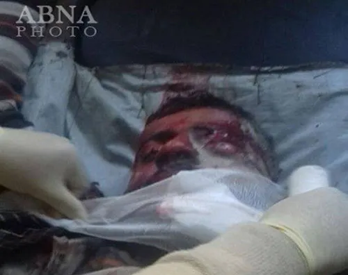 IS bị tố sử dụng vũ khí hóa học tại Syria khiến 20 người bị thương