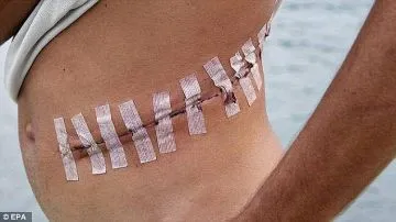 ISIS đang buôn nội tạng của các thành viên đã chết