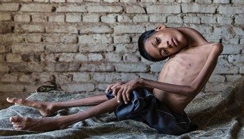 Kinh ngạc cậu bé uốn cổ ra sau 180 độ.