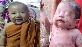 Cứu sống bé sơ sinh bị chôn sống