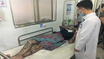TPHCM: Tập trung xử lý ổ bệnh thủy đậu tại Khu chế xuất Tân Thuận