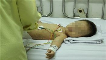 Thông tin về ca nghi nhiễm não mô cầu tử vong TPHCM