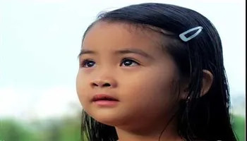 Bé bị lác trong, viễn thị có đáng ngại?