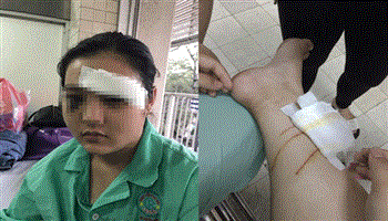 Yêu cầu điều tra vụ bán lao động đi biển, cắt tai thiếu nữ giữa Sài Gòn
