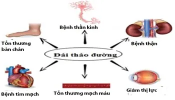 Cách xử lý các biến chứng nguy hiểm của bệnh tiểu đường