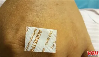 Viên thuốc còn nguyên vỏ bao nhôm kẹt ở thực quản 10 ngày