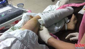 Không gây mê, mổ ghép xương thành công cho bệnh nhân bị Tứ chứng Fallot nguy hiểm