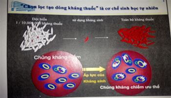 Một nửa kháng sinh kê đơn là không cần thiết