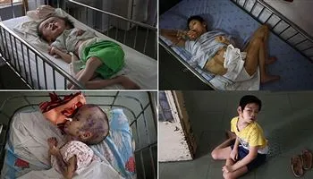 Chính sách đối với người hoạt động kháng chiến nhiễm chất độc hóa học