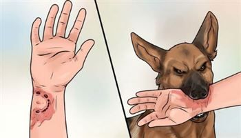 Cục Y tế dự phòng khuyến cáo về phòng, chống bệnh dại trong mùa nắng nóng