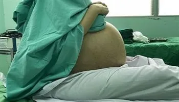 Bướu 18 kg, cứ tưởng mập bụng