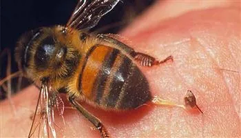 LƯU Ý: Cách sơ cấp cứu khi trẻ bị ong đốt