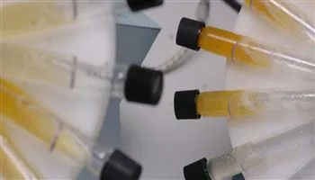 MỚI: Sắp có que thử xét nghiệm phát hiện ung thư sớm ở giai đoạn đầu