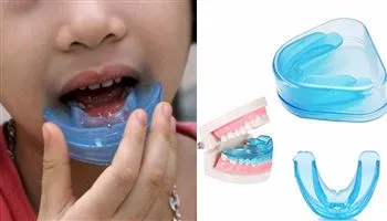 Cẩn trọng khi dùng miếng niềng răng silicone cho trẻ em