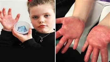 Slime - đồ chơi yêu thích của trẻ nhỏ: Lợi ít hại nhiều