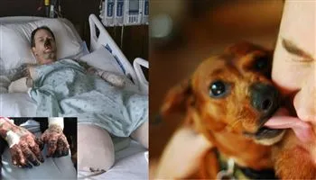KHUYẾN CÁO: Đừng vì yêu chó mà để chó liếm mặt, kẻo rước bệnh vào người như người đàn ông này