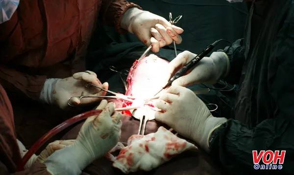 Một ca phẫu thuật bắt con tại Bệnh viện Hùng Vương