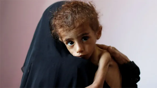nạn đói tại Yemen