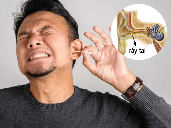 Có nên hay không việc thường xuyên ngoáy tai khi bị ngứa? 1