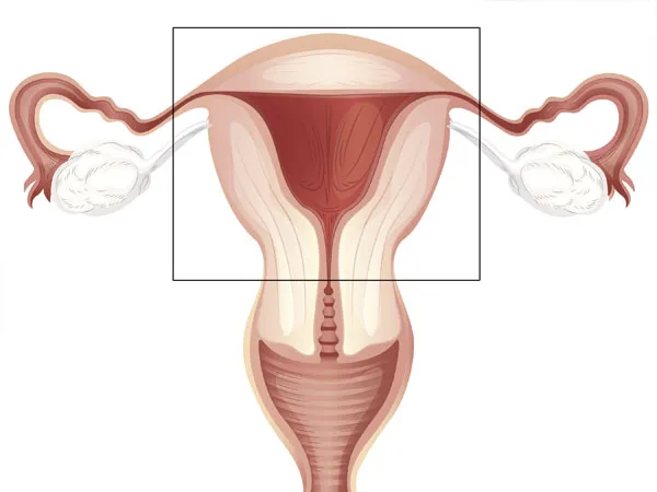 Tử cung nhỏ ảnh hưởng đến khả năng mang thai như thế nào? 1