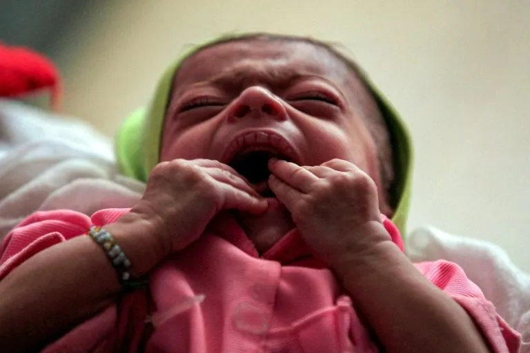 Một em bé bị suy dinh dưỡng ở Yemen