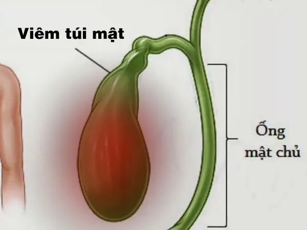 viem-tui-mat-nguyen-nhan-bieu-hien-bien-chung-va-cach-dieu-tri-voh-1