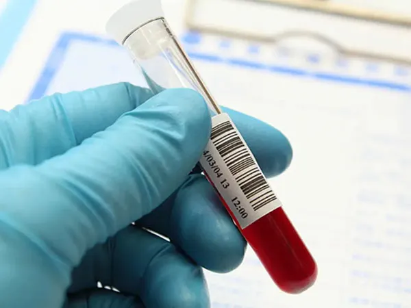 xet-nghiem-karyotype-la-gi-khi-nao-can-thuc-hien-1-voh