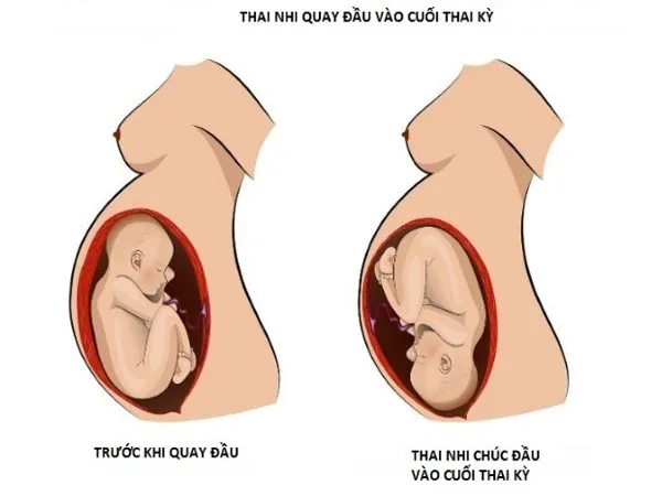 thai-nhi-quay-dau-som-co-nguy-hiem-khong-lam-sao-nhan-biet-voh