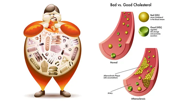 Vì một trái tim khỏe, hãy kiểm tra cholesterol của cơ thể ngay từ tuổi 25