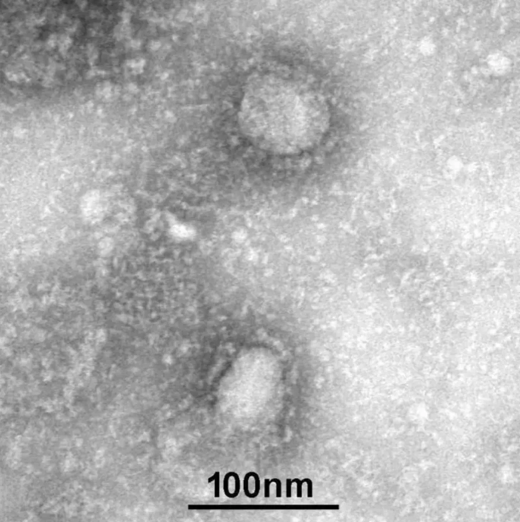 Trung Quốc công bố những hình ảnh đầu tiên của virus Vũ Hán. Ảnh: Viện Vi sinh tại Học viện Khoa học Trung Quốc