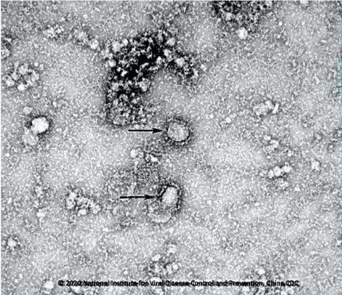 Trung Quốc công bố những hình ảnh đầu tiên của virus Vũ Hán. Ảnh: Viện Vi sinh tại Học viện Khoa học Trung Quốc