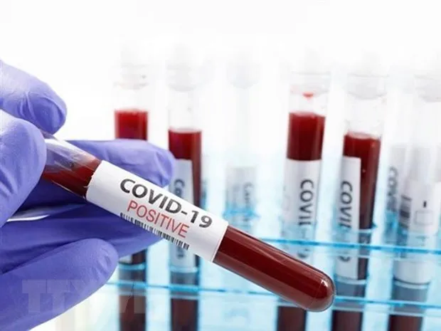Anh sản xuất gấp 1 triệu liều vắcxin phòng bệnh COVID-19