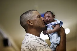Một em bé ở Brazil mắc chứng đầu nhỏ do mẹ bé nhiễm virus Zika trong thai kỳ 