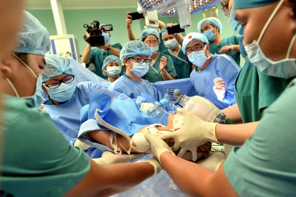 Báo chí quốc tế đưa tin về cuộc phẫu thuật tách rời hai bé song sinh Trúc Nhi và Diệu Nhi