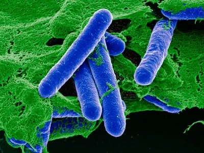 Vi khuẩn Clostridium botulinum - thủ phạm gây ngộ độc thực phẩm.